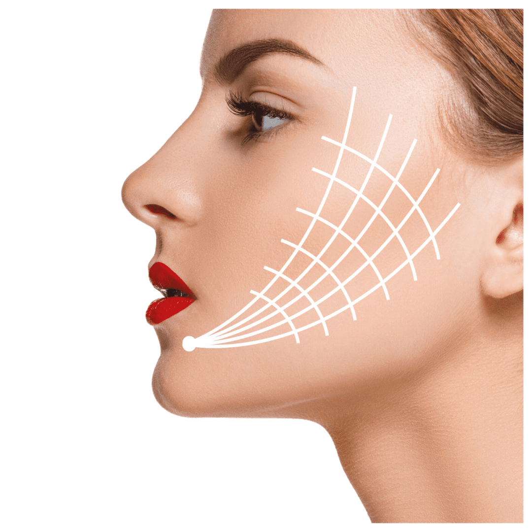 Thread Lifts treatment