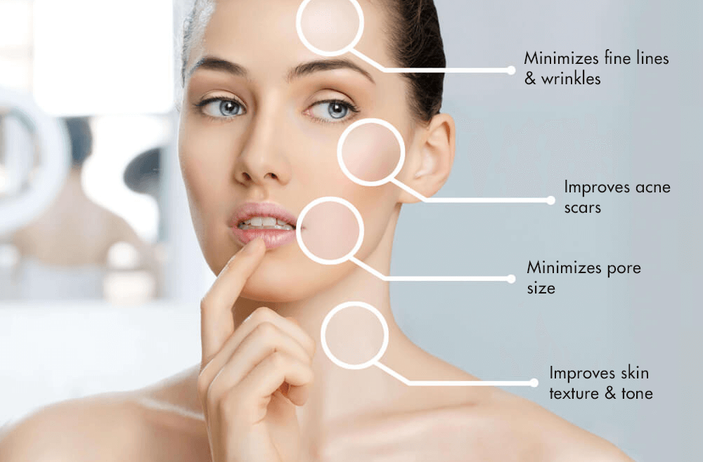 skin mesotherapy