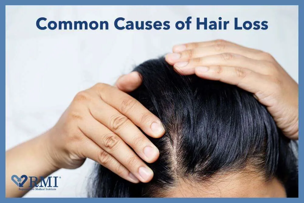 Hair Loss Concern