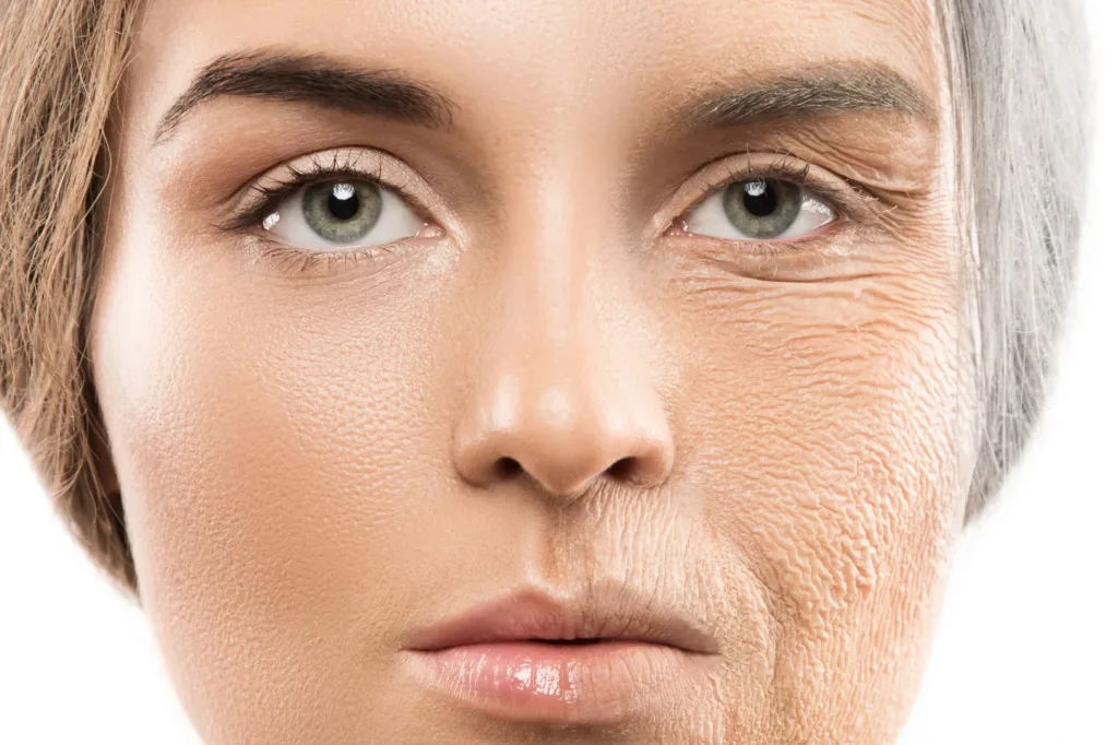 Lines and wrinkles